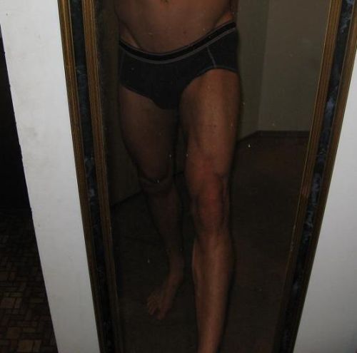 Legs